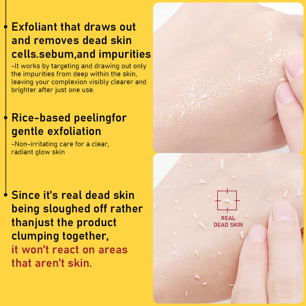 Phofay Exfoliat Bromelain